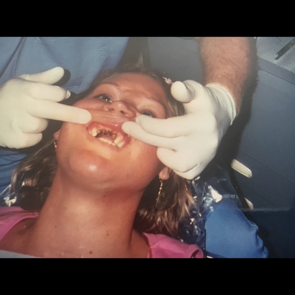 All Sales Are Going To Fund My Dental Work Needed - Picture 7 of 8
